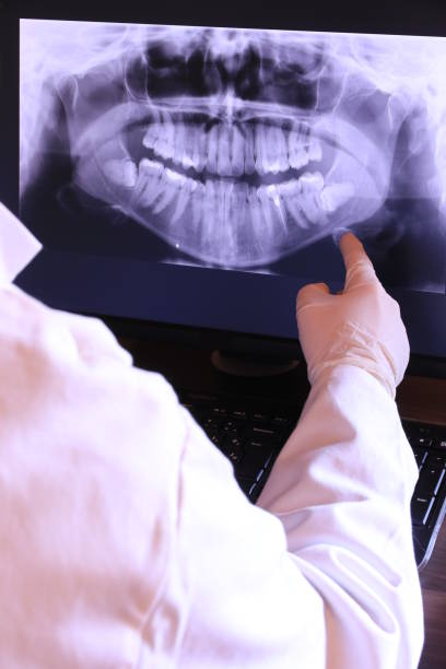 Best Cosmetic Emergency Dentistry in Ferndale, WA